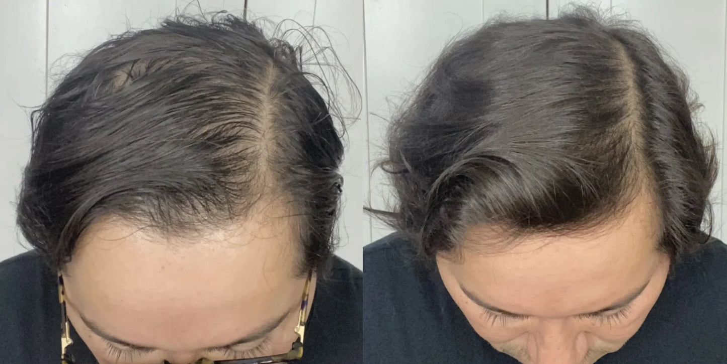 Adivasi Jeeva Sanjivani Herbal Hair Oil (Buy 1 get 1 Free) summer offer